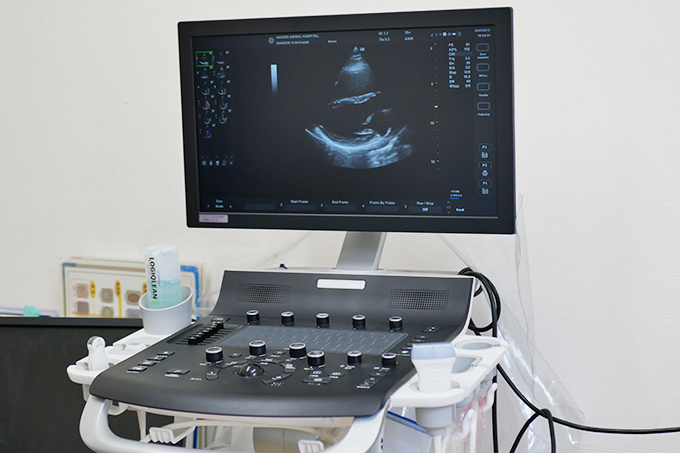 超音波診断装置